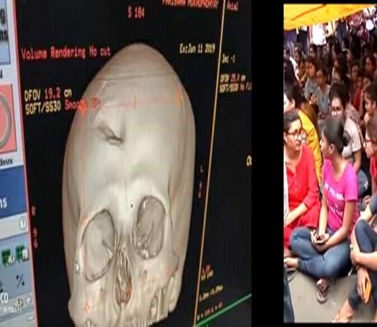 এন আর এস কাণ্ডে রাজ্যের সব মেডিক্যাল কলেজ হাসপাতালে অচলাবস্থা/The News বাংলা